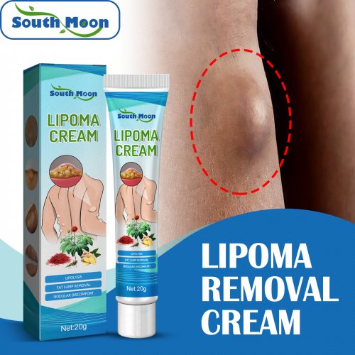 South Moon Lipoma Removal Cream-20g